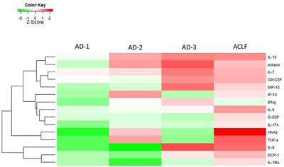 Addressing Profiles of Systemic Inflammation Across the Different Clinical Phenotypes of Acutely Decompensated Cirrhosis